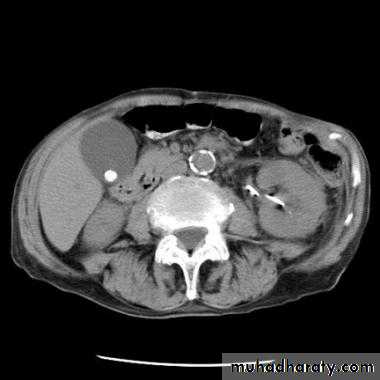 Imaging of GIT diseases