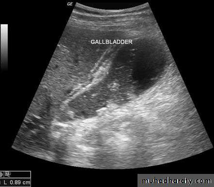 Imaging of GIT diseases