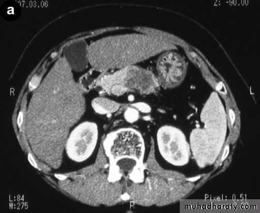 Imaging of GIT diseases