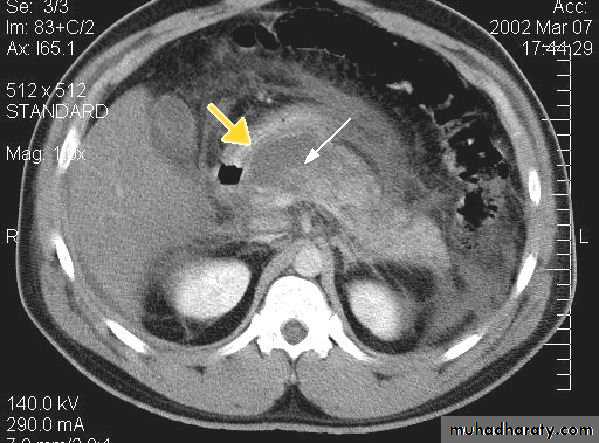 Imaging of GIT diseases