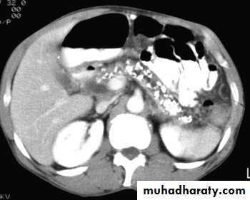 Imaging of GIT diseases
