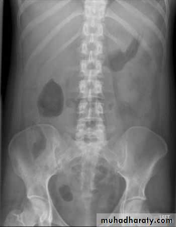 Imaging of GIT diseases