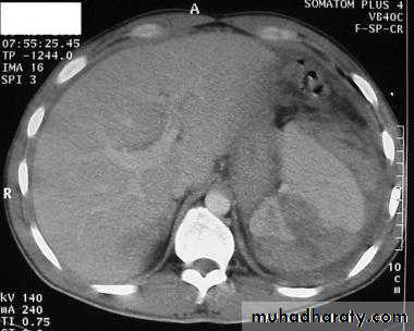 Imaging of GIT diseases