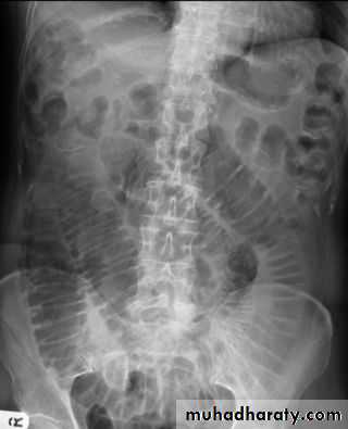 Imaging of GIT diseases