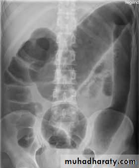 Imaging of GIT diseases