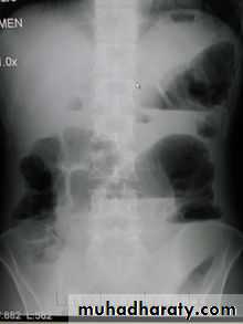 Imaging of GIT diseases