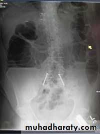 Imaging of GIT diseases
