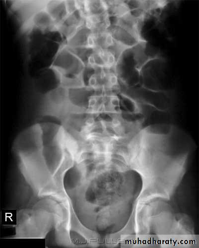 Imaging of GIT diseases