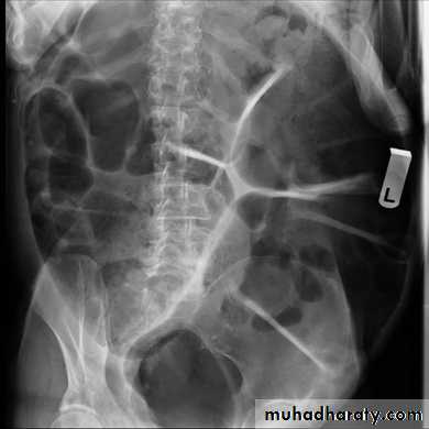 Imaging of GIT diseases