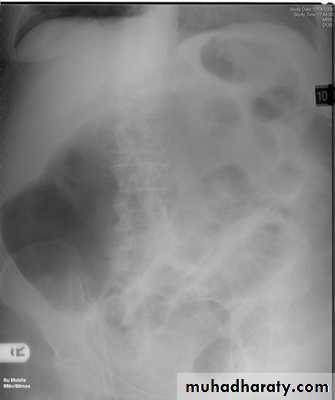 Imaging of GIT diseases