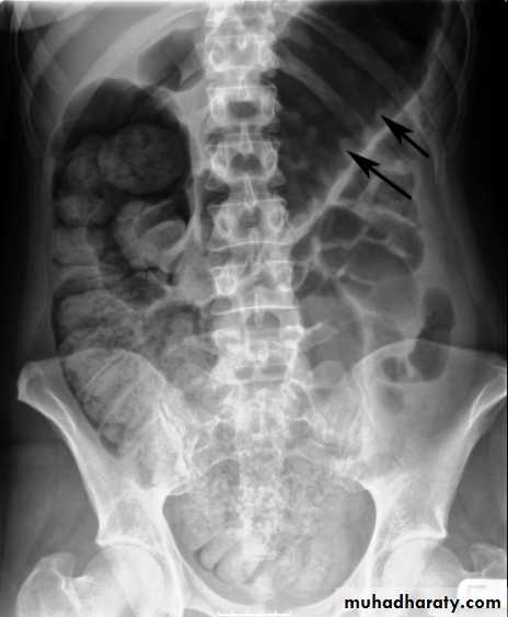 Imaging of GIT diseases