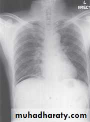 Imaging of GIT diseases