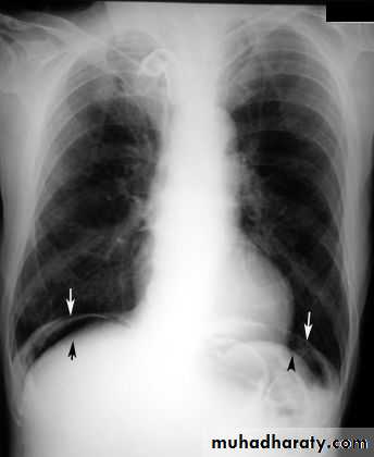 Imaging of GIT diseases