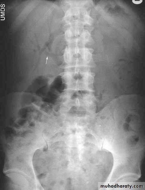 Imaging of GIT diseases