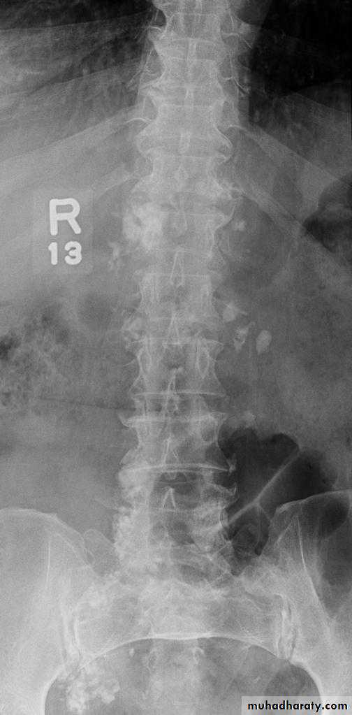 Imaging of GIT diseases
