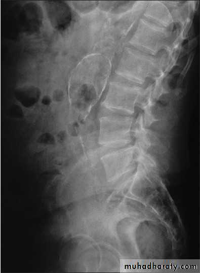 Imaging of GIT diseases