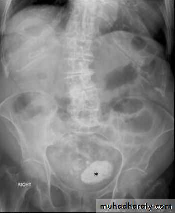 Imaging of GIT diseases