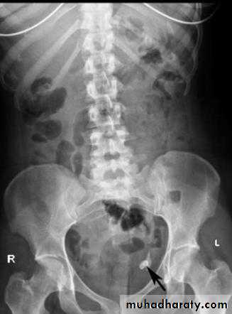 Imaging of GIT diseases