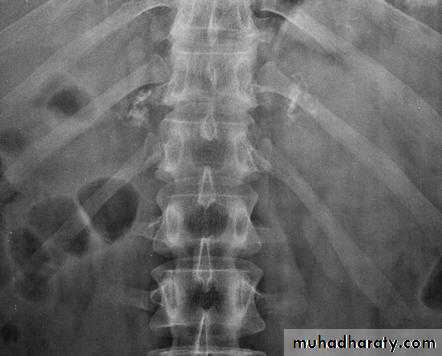 Imaging of GIT diseases