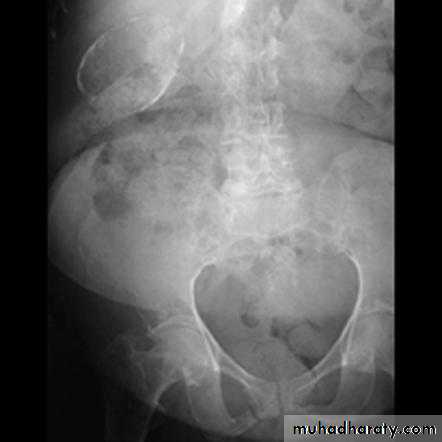 Imaging of GIT diseases