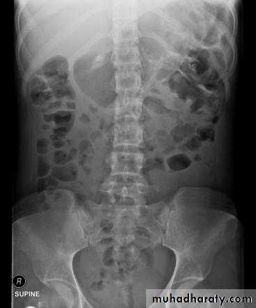Imaging of GIT diseases