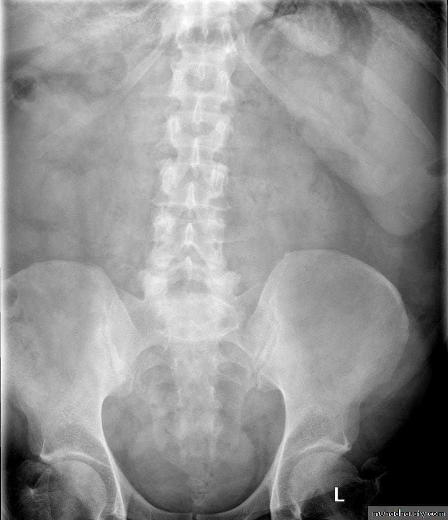 Imaging of GIT diseases