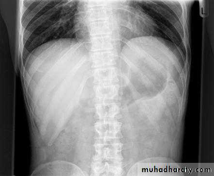 Imaging of GIT diseases