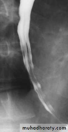 Imaging of GIT diseases