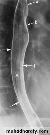 Imaging of GIT diseases