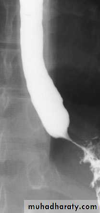 Imaging of GIT diseases