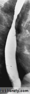 Imaging of GIT diseases