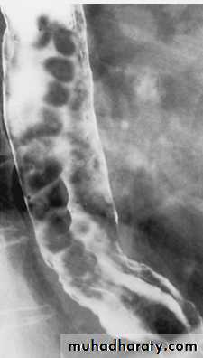 Imaging of GIT diseases