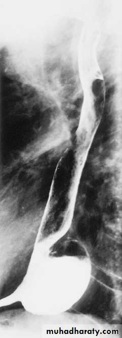Imaging of GIT diseases