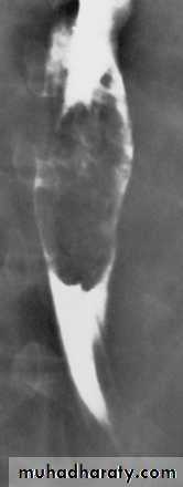 Imaging of GIT diseases