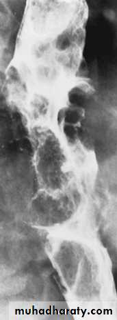 Imaging of GIT diseases