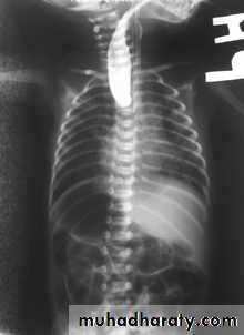 Imaging of GIT diseases