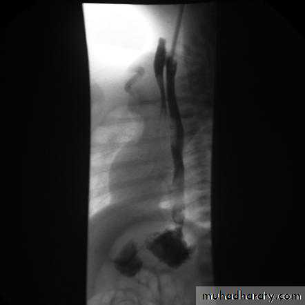 Imaging of GIT diseases