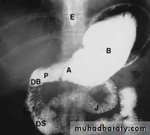 Imaging of GIT diseases