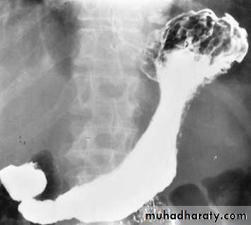 Imaging of GIT diseases