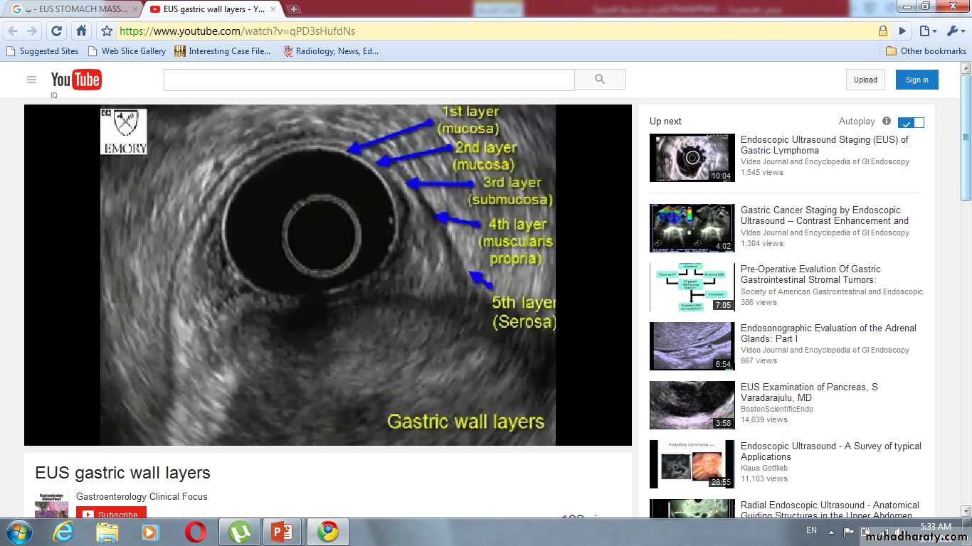 Imaging of GIT diseases