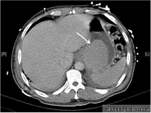 Imaging of GIT diseases