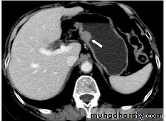Imaging of GIT diseases