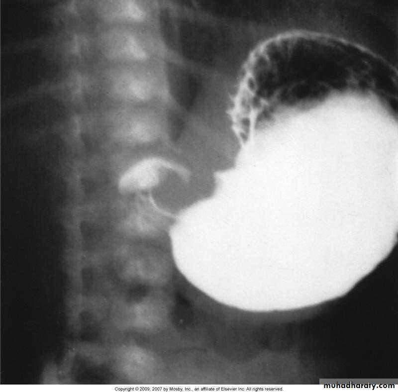 Imaging of GIT diseases