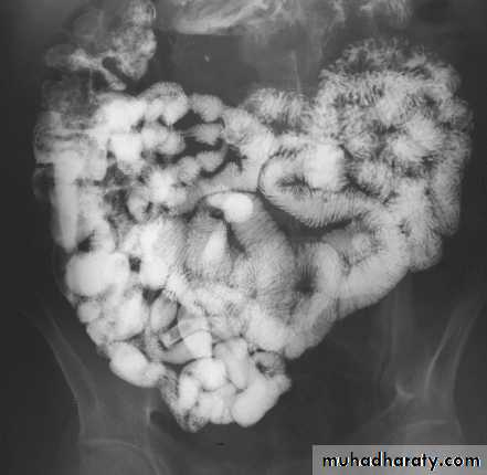 Imaging of GIT diseases