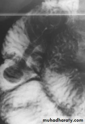 Imaging of GIT diseases