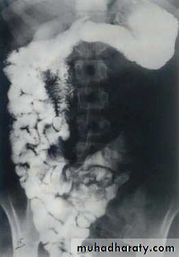 Imaging of GIT diseases