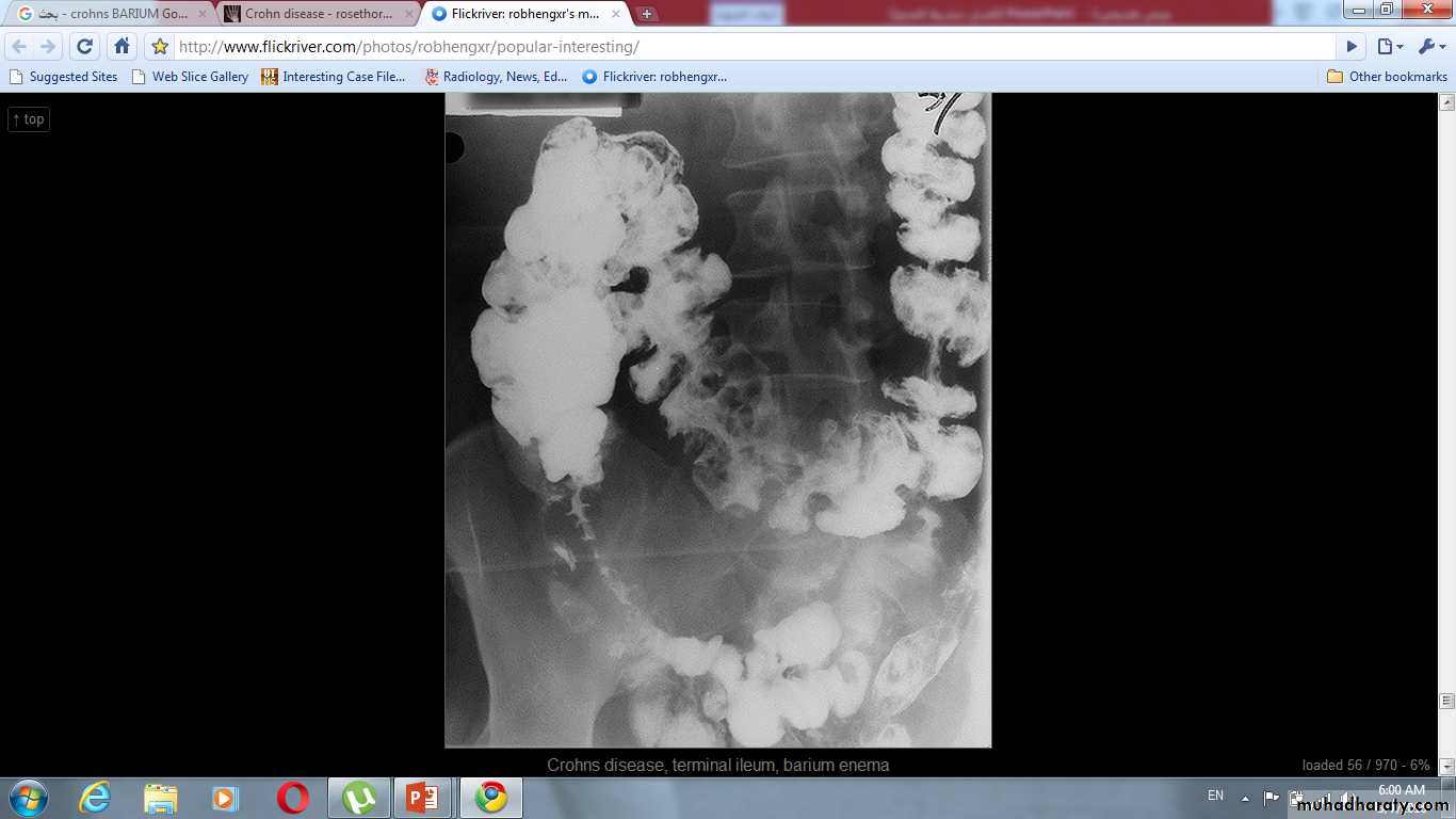 Imaging of GIT diseases