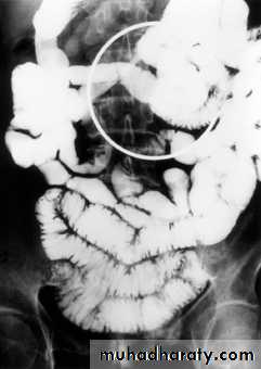 Imaging of GIT diseases