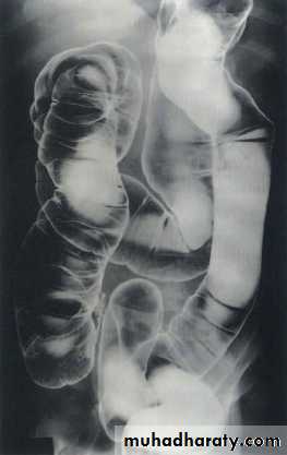 Imaging of GIT diseases