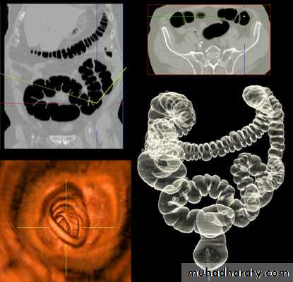 Imaging of GIT diseases